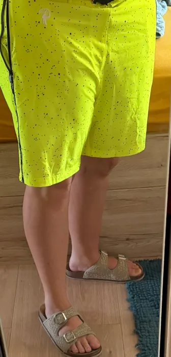 Customer photo from Angelina S. review of Speckle - Fluro 7"